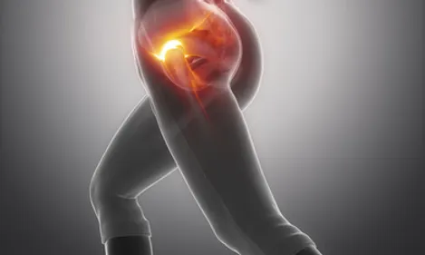 An image of a woman with a PNMT pain in her hip.